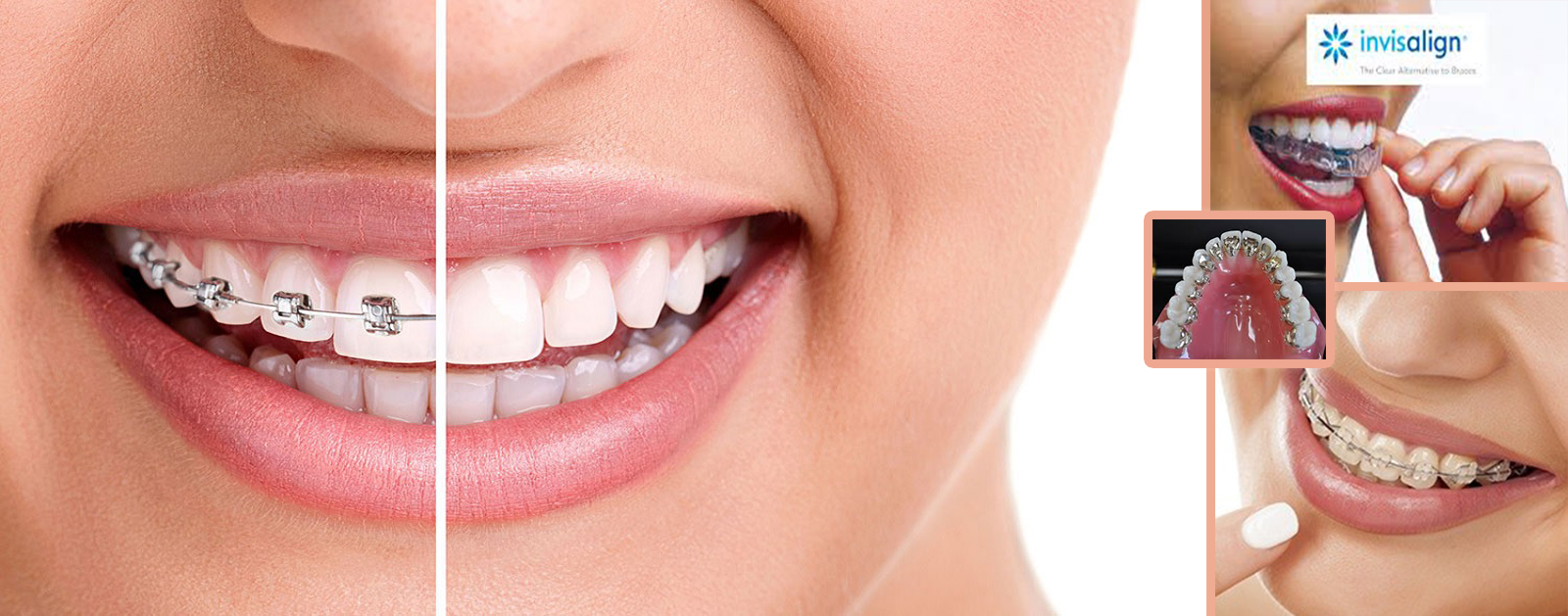 Dental Care Solution - Dentist & Orthodontist