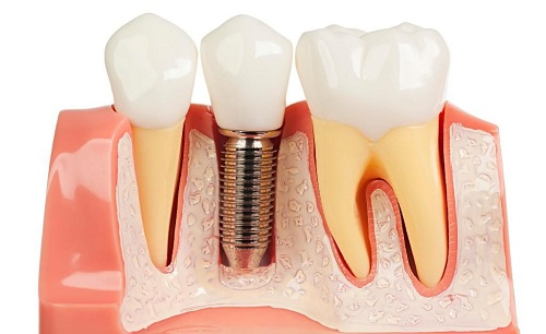 Dental Care Solution - Dentist & Orthodontist